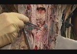 ТВ Анатомия для начинающих / Anatomy for Beginners (2005) - cцена 7